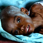 Starving child in Ethiopia